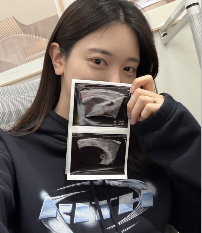 ‘얼짱 레전드’ 유혜주, 둘째 축복 찾아왔다… 남편 ‘뱀 태몽’ 듣고 울컥