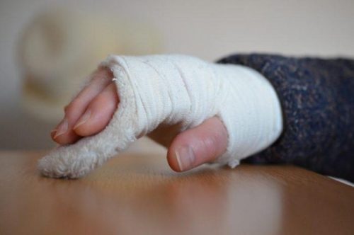 “혹한기 빙판 넘어짐 사고 급증… 치료비 보험금 놓고 소비자, 보험사 예견된 싸움이었나”